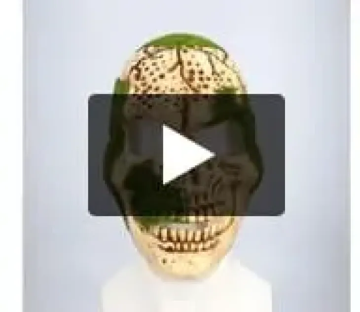 Naamari suokallo